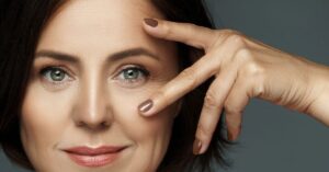 Bőr öregedése? Mit érdemes tudni róla és a kezelésről?